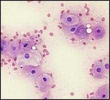 Example of cells taken from a Rottweiler bitch at diestrus.